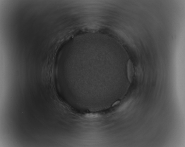 X0000093170818200710031502