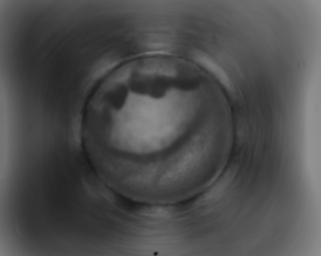 X0000093171411200710031455