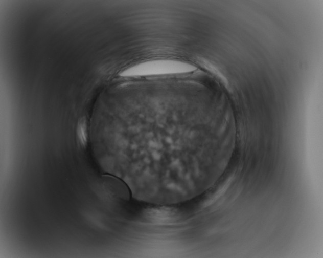 X0000093170069200710101220
