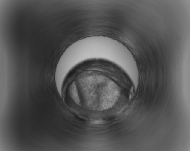 X0000093170237200710101218