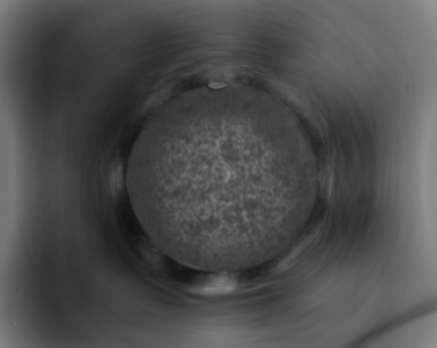 X0000093170335200710101217