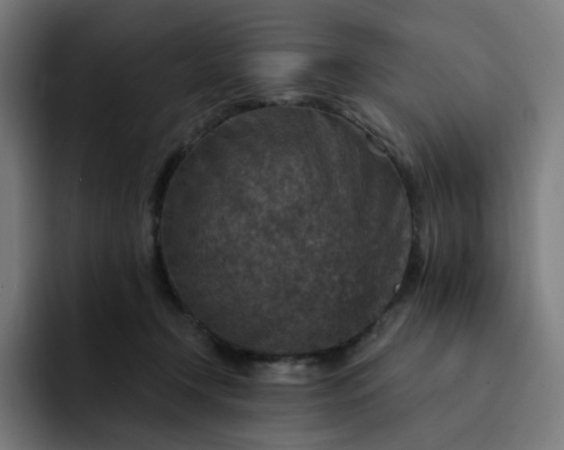 X0000093170366200710101217