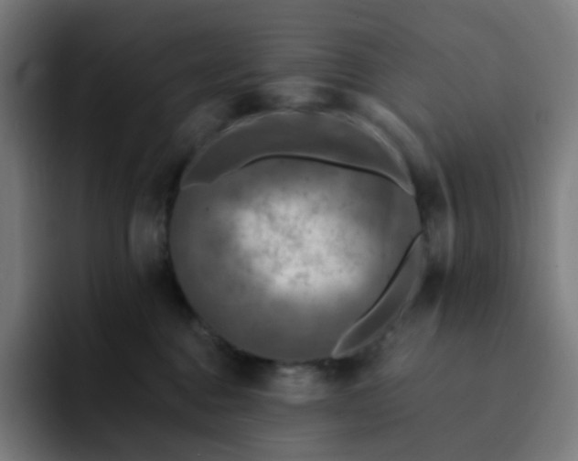X0000093170376200710101217