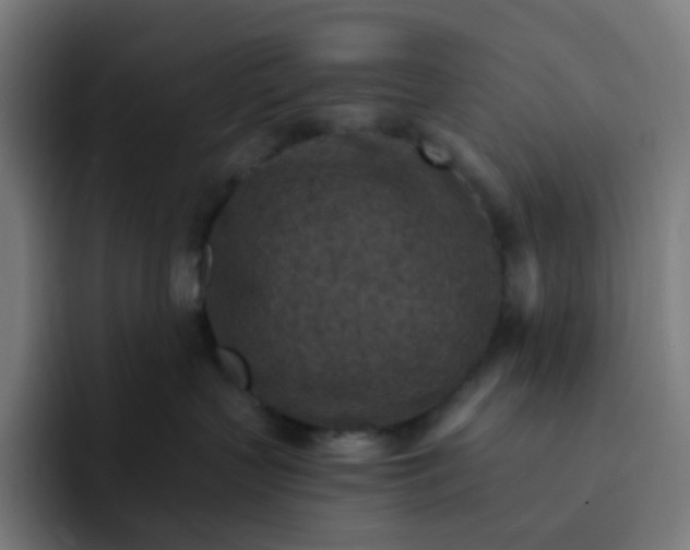 X0000093170383200710101217