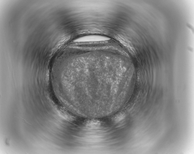 X0000093170206200710241046