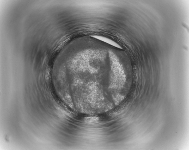 X0000093170266200710241045