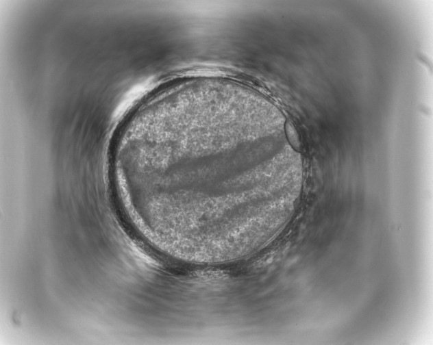 X0000093170296200710241045