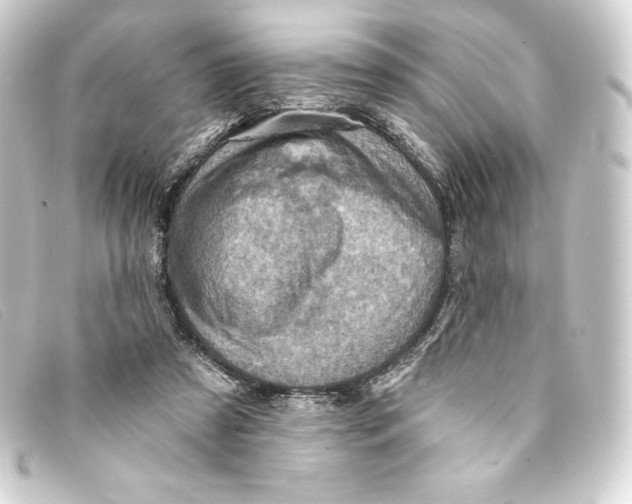 X0000093170305200710241045