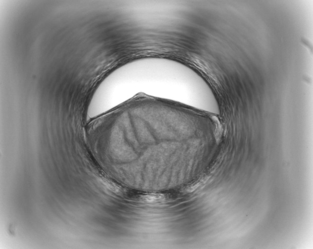 X0000093170317200710241045