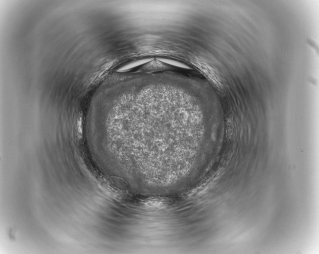 X0000093170358200710241044