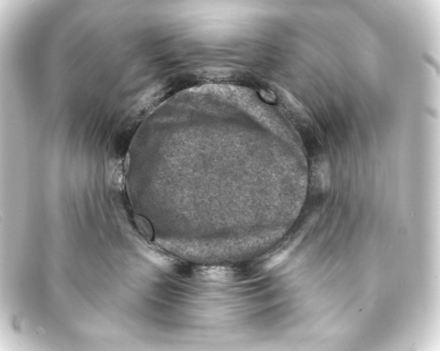 X0000093170383200710241045