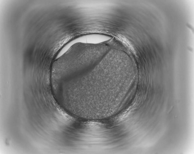 X0000093170393200710241044