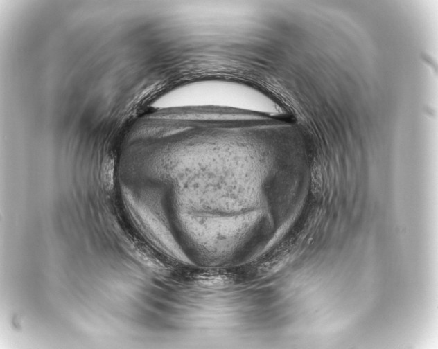 X0000093170454200710241043