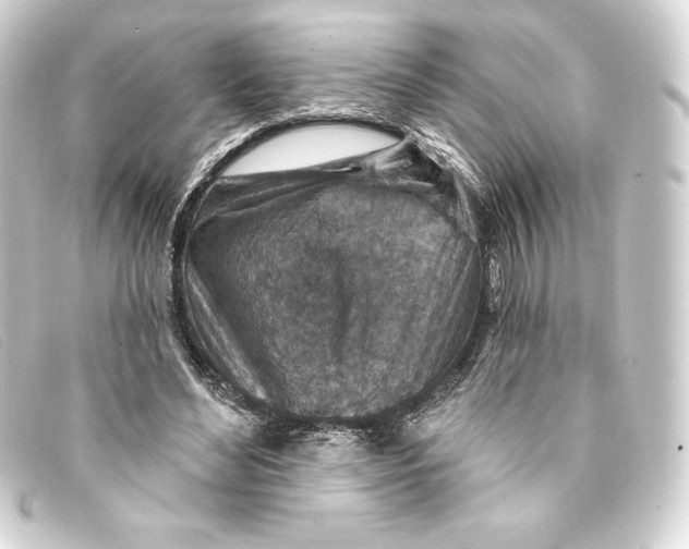 X0000093170492200710241042