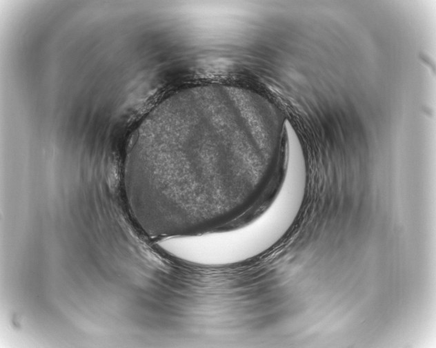 X0000093170566200710241042