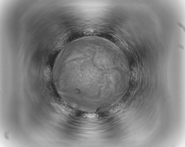 X0000093170659200710241040