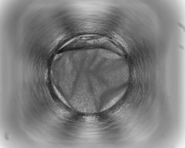 X0000093170693200710241040