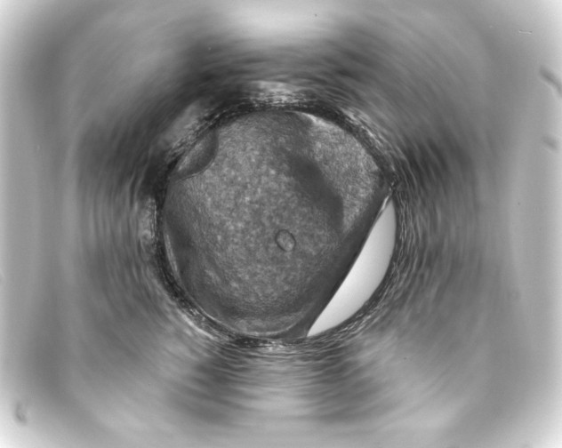 X0000093170760200710241039