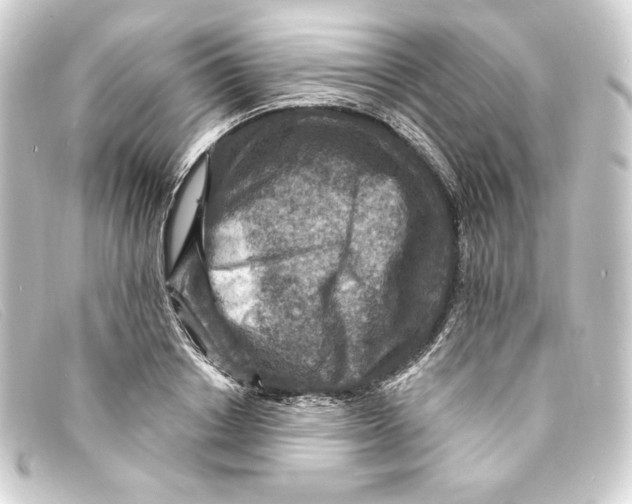 X0000093170842200710241038