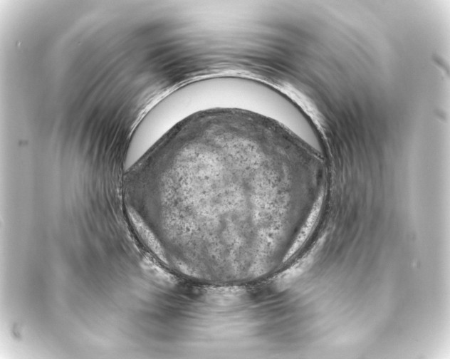 X0000093171001200710241036