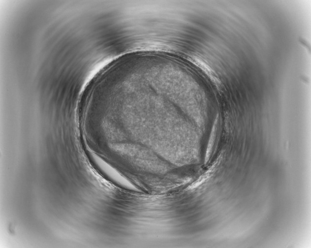 X0000093171120200710241034