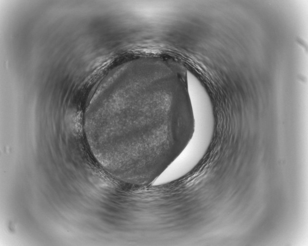 X0000093171156200710241034