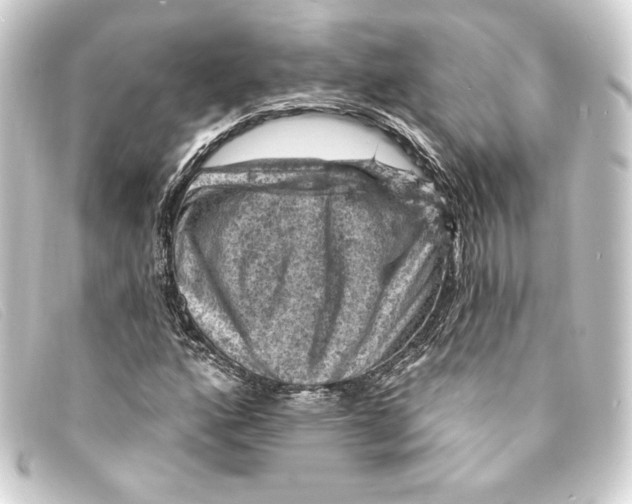 X0000093171160200710241034