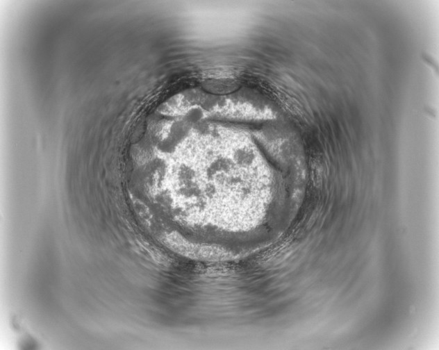 X0000093171393200710241030