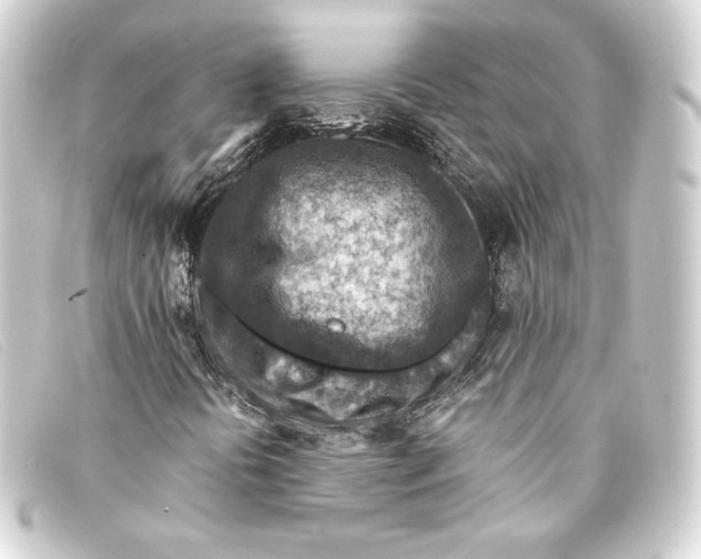 X0000093171394200710241030