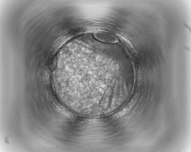 X0000093171401200710241030