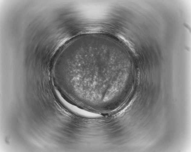 X0000093171449200710241030