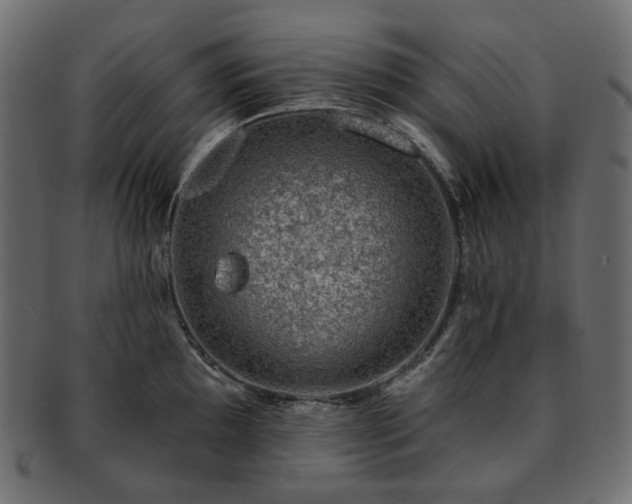 X0000093211097200710031415