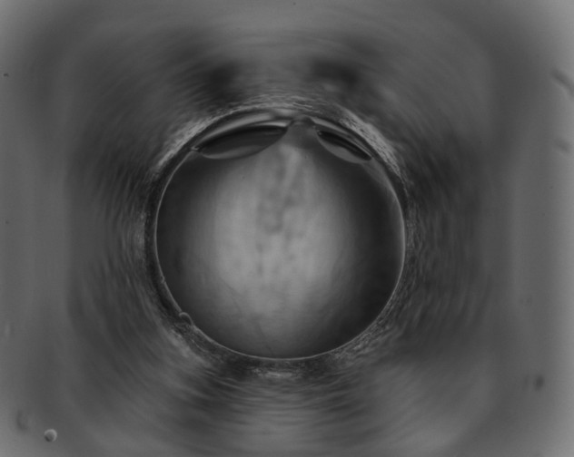 X0000093220155200710031446