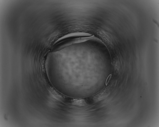 X0000093220185200710031446