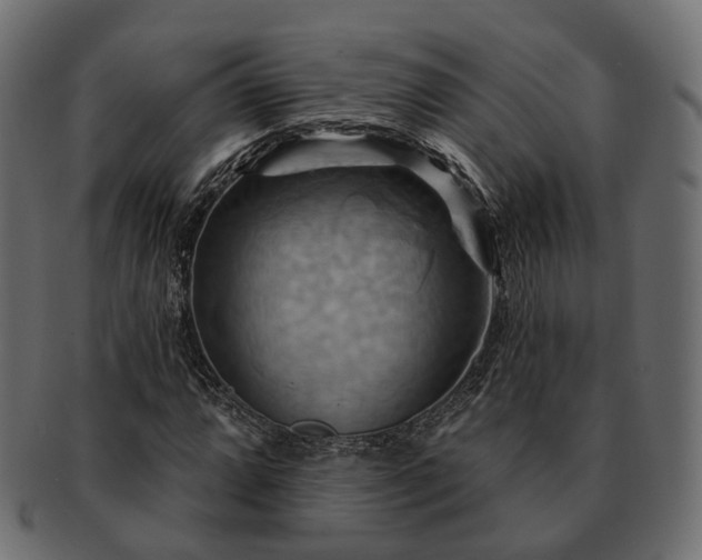 X0000093221064200710031435