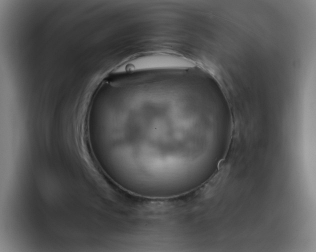 X0000093220145200710101351