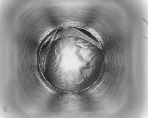 X0000093220581200710241218