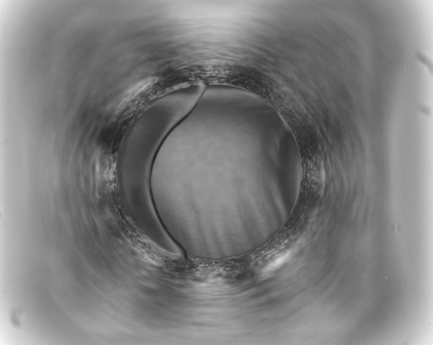 X0000093220818200710241215