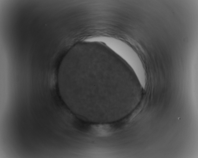 X0000093230517200710101406