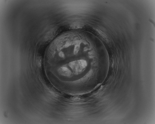 X0000093240315200710031607