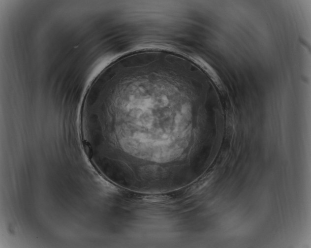 X0000093241199200710031556