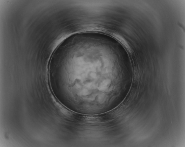 X0000093241439200710031553