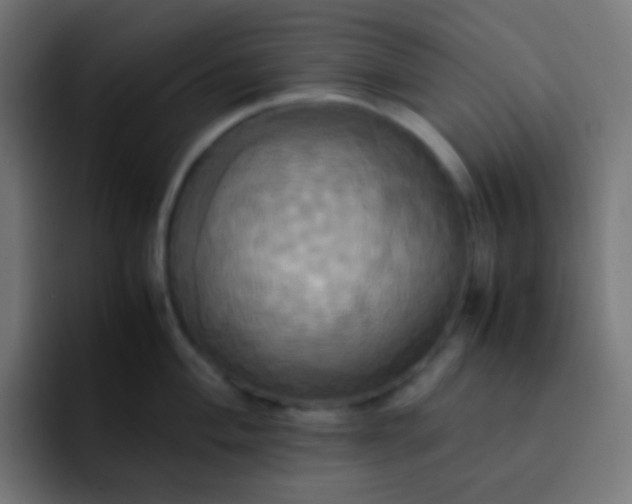 X0000093241004200710101418