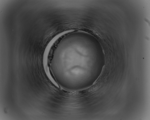 X0000093240720200710171441