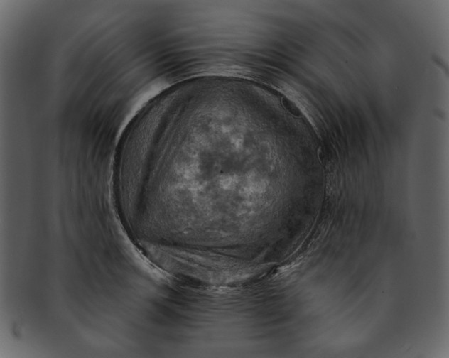 X0000093241139200710171435