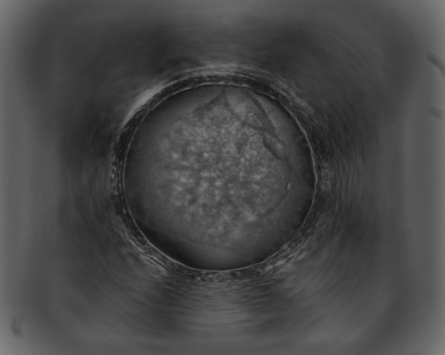 X0000093241208200710171433