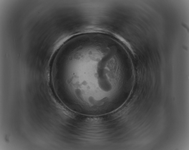 X0000093251415200709261710