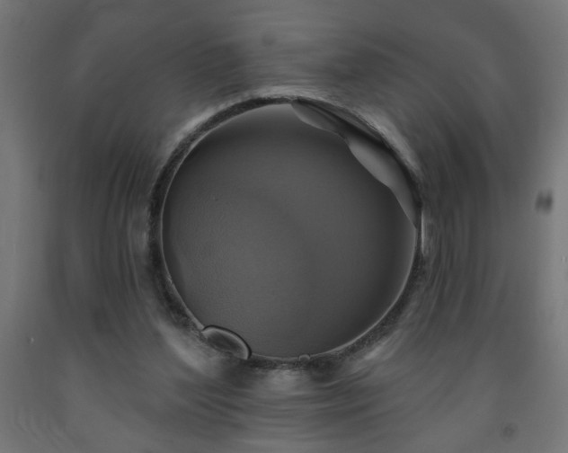 X0000093250204200710031611