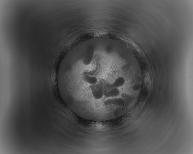 X0000093250565200710101443