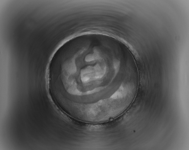 X0000093251522200710101431